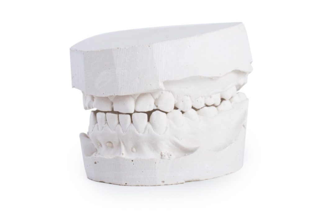 teeth mold