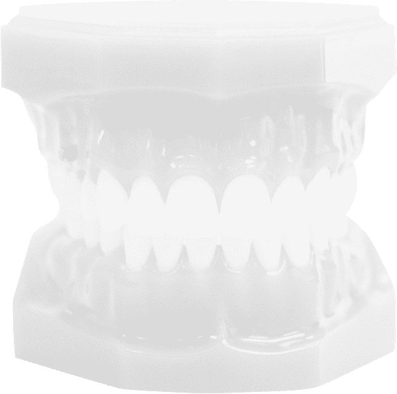 lingual braces model